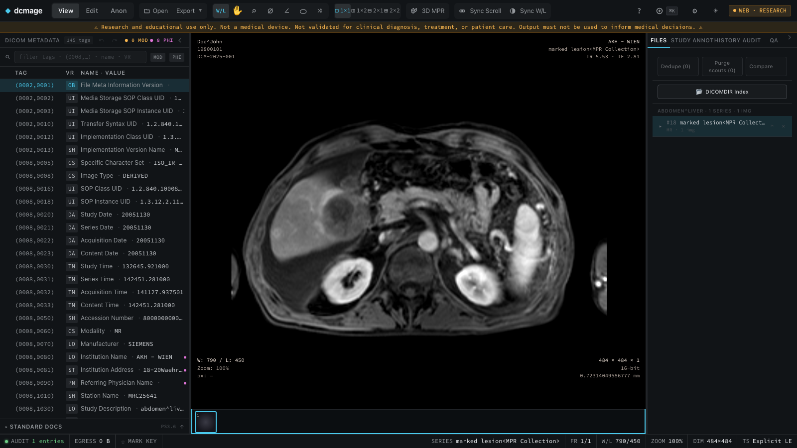 dcmage viewer showing MR DICOM metadata and image